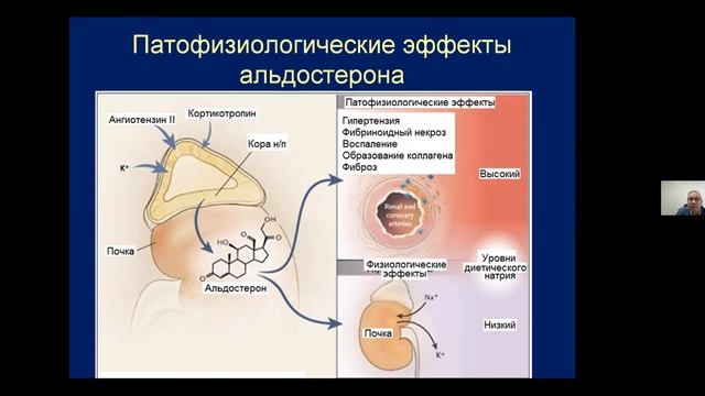 Симптоматические артериальные гипертензии.mp4
