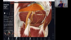 Защемление седалищного нерва.