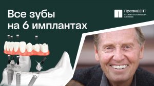 👌🏻 Как восстановить зубной ряд? С помощью имплантации All on 6 Как восстановить зубной ряд.