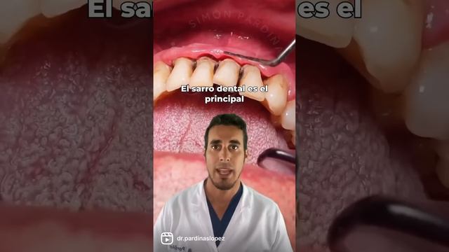 ¿Tienes las ENCÍAS DESPEGADAS? Si te ocurre ESTO deberías ir al DENTISTA