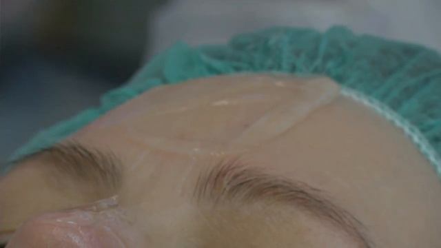 Uus kõrgtehnoloogiline IPL laseraparaat nüüd Medemises! смотреть онлайн