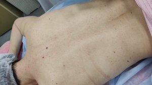 Сосудистый этап по телу