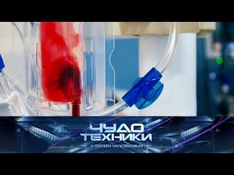 "Чудо техники": Что нужно знать о крови, плюсы японской мочалки и вантуза с гидроударом (18.02.2018)