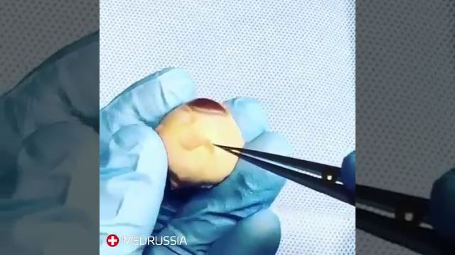 Мышцы глаза смотреть онлайн