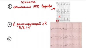 ЭКГ У ДЕТЕЙ. Особенности анализа ЭКГ. Отличие от взрослой ЭКГ.