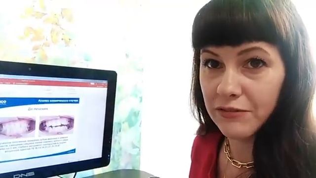 ✅ Отзыв: об исправлении прикуса ортодонт Маргарита Алексеевна Зинченко клиника Ортодонт Эстетик
