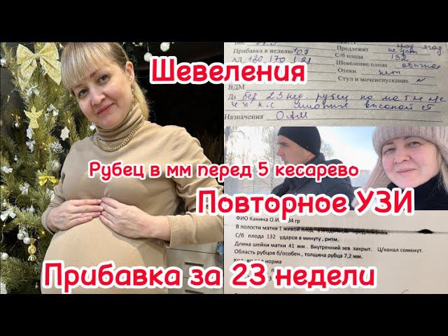 ВРАЧ ВОЛНУЕТСЯ⚕️ПОВТОРНОЕ УЗИМОЙ ВЕС ЗА 23 НЕДЕЛИ⚖️ПЕРВЫЕ ШЕВЕЛЕНИЯ
