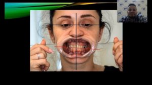 Вебинар. Гнатология. Тимур Захаров