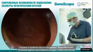 «СОВРЕМЕННЫЕ ВОЗМОЖНОСТИ ЭНДОСКОПИИ: ЭКСПЕРТЫ ПРАКТИЧЕСКИМ ВРАЧАМ» ОБРАЗОВАТЕЛЬНАЯ ВЕБ КОНФЕРЕНЦИЯ