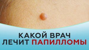 Какой врач лечит папилломы.