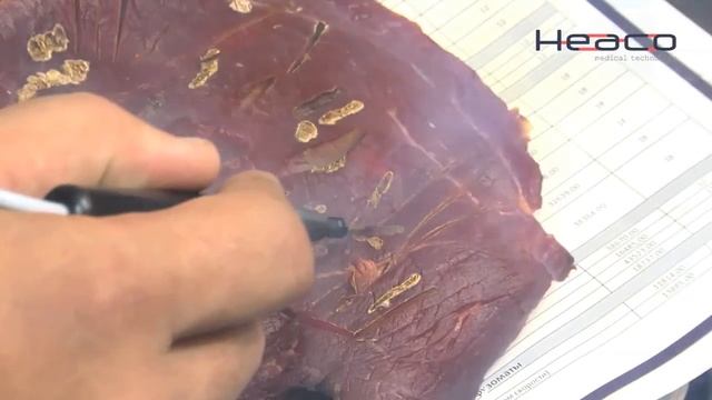 Плазменный коагулятор ARGON Z HEACO смотреть онлайн