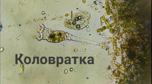 Хищная сидячая коловратка