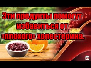 Эти продукты помогут избавиться от «плохого» холестерина.
