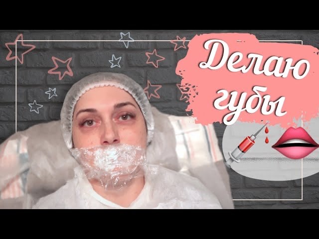УВЕЛИЧЕНИЕ ГУБ ДО и ПОСЛЕ | ожидание vs реальность | филеры