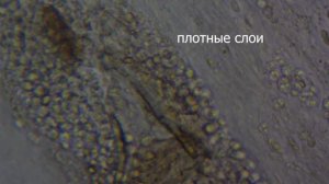 Чайный гриб под микроскопом #микромир