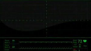 heart beat monitor animation free stock footage