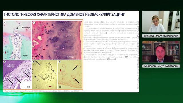 2024 г. Новости медицины «Достоверно об остеоартрите» _ 06.03.2024