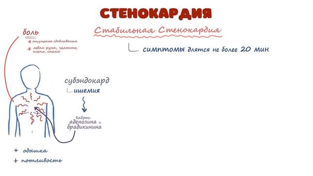 Стенокардия - причины, симптомы (лекция) Osmosis
