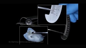 изготовление зуба собственными руками