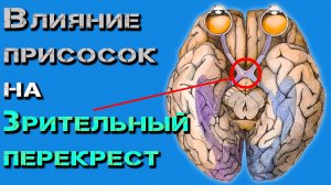 Влияние присосок от тёмных на Зрительный перекрест