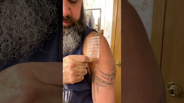 Full Shoulder Replacement Scar Reveal