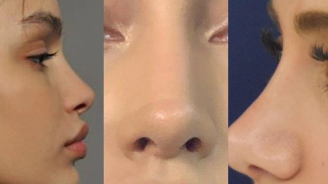 уменьшение носа саблиминал+песня высоких вибрации смотреть онлайн