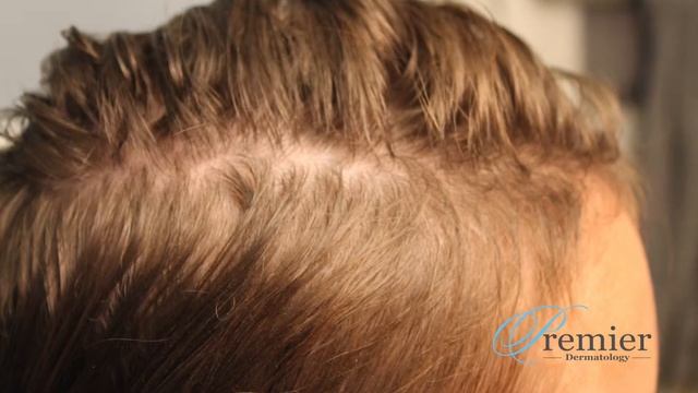 Light Therapy: Hair Restoration смотреть онлайн