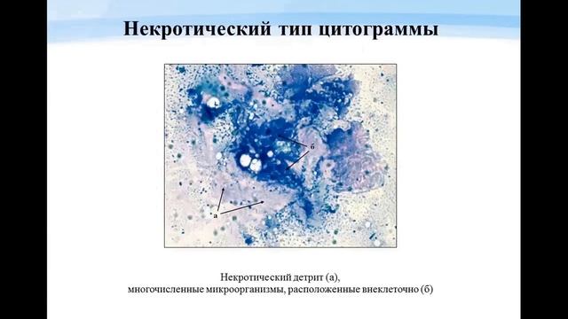 Определение типа цитограммы огнестрельной раны в ходе ее заживления смотреть онлайн