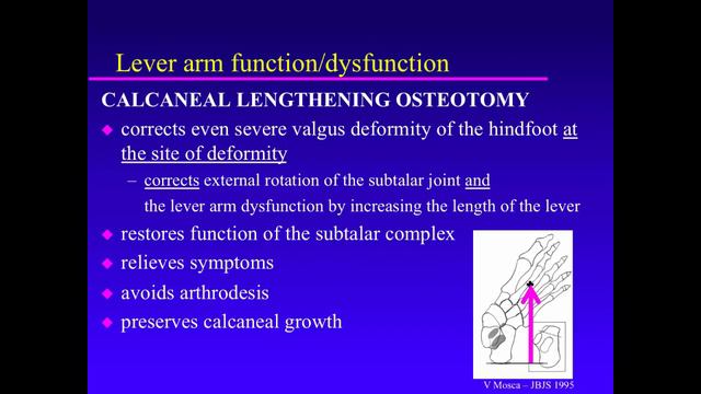 Biomechanics Of The Pediatric Foot. Principle 08. Lever Arm Function