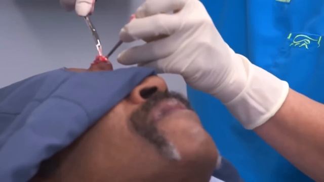 Top 3 Most Viewed Dr Pimple Popper videos in 2021 | Dr. Pimple Popper смотреть онлайн