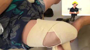 Как подготовить культю к протезированию?