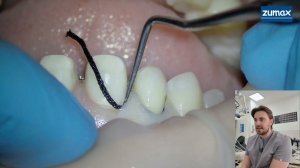 СТОМБУДНИ#36 РЕТРАКЦИЯ И ОТТИСК