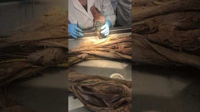 Топографическая анатомия нижней конечности