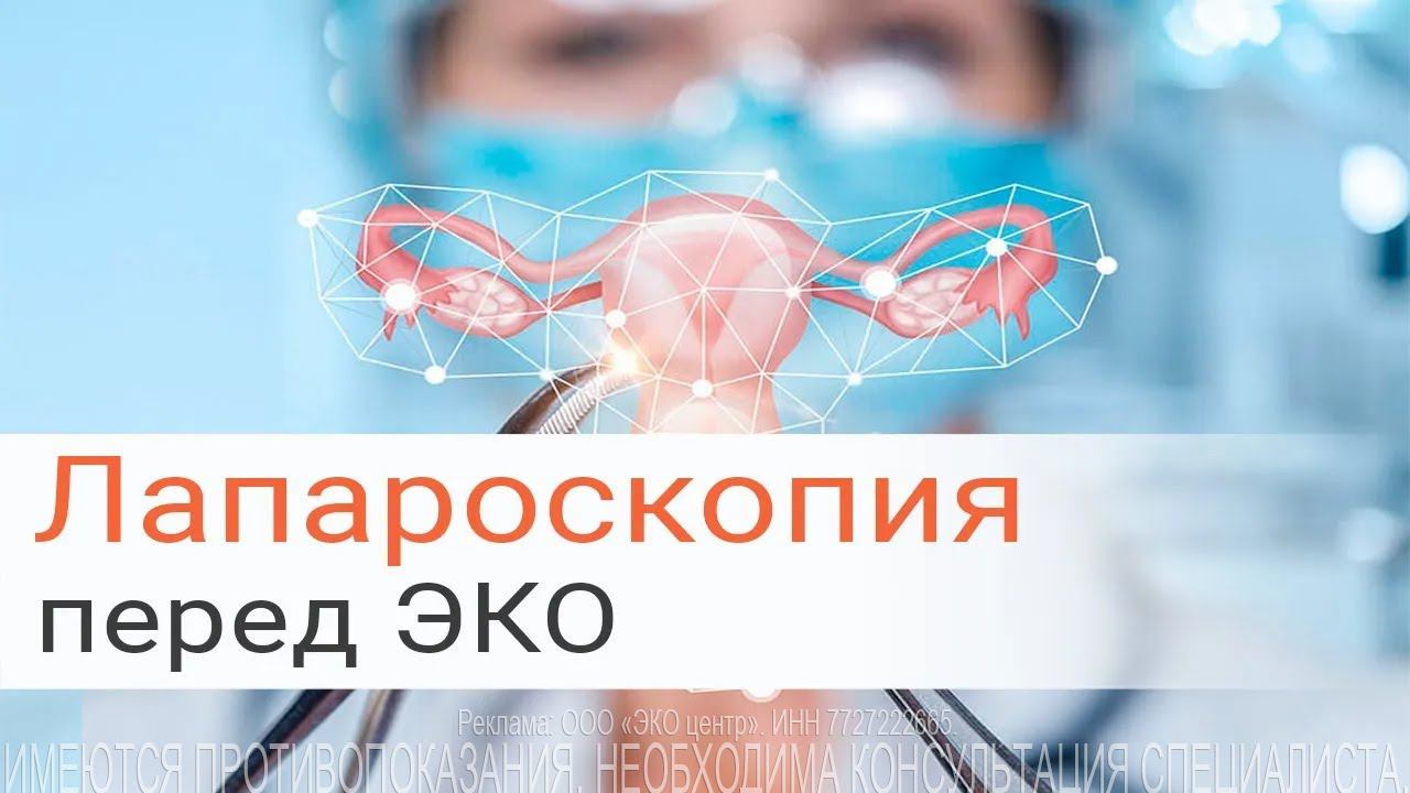 Лапароскопия в гинекологии и перед ЭКО
