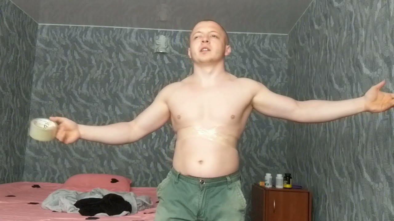 УЖАСНЫЕ ПОСЛЕДСТВИЯ ПЕРЕЛОМА РЕБЕР. ЧТО СО МНОЙ СЛУЧИЛОСЬ ПОСЛЕ АВАРИИ?