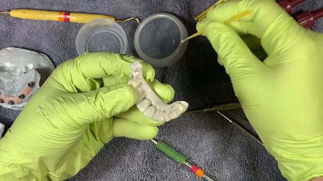 Diseño, fabricación y ensamblaje de una prótesis en JUVORA PEEK. смотреть онлайн