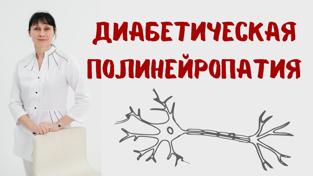 Нейропатия врач. ПОЛИНЕЙРОВИТ. Полинейропатия. Диабетической полинейропатии.