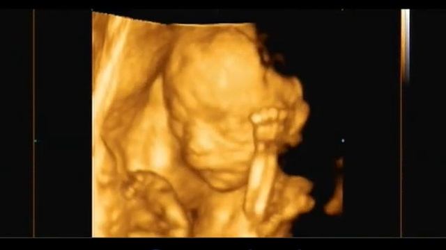 3д узи во втором триместре беременности смотреть онлайн