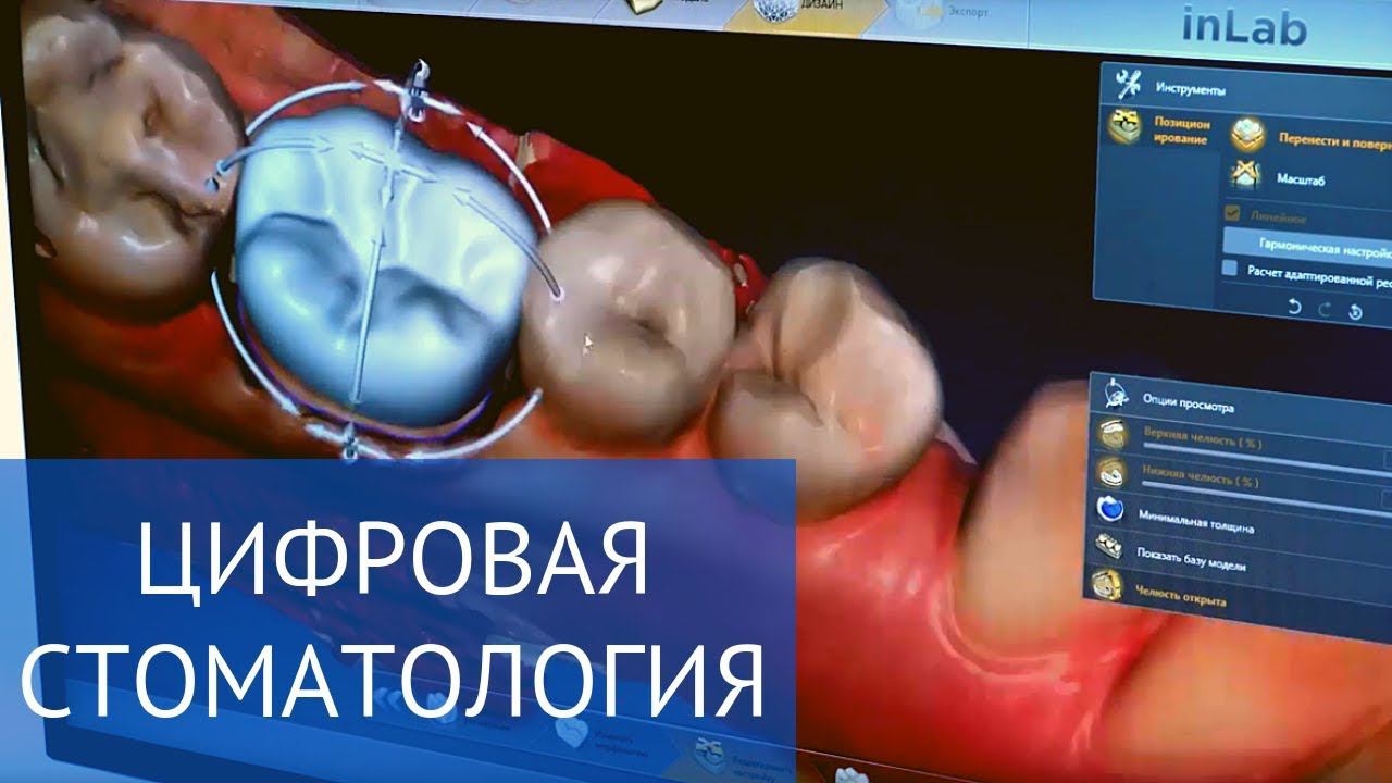 Цифровые технологии в стоматологии