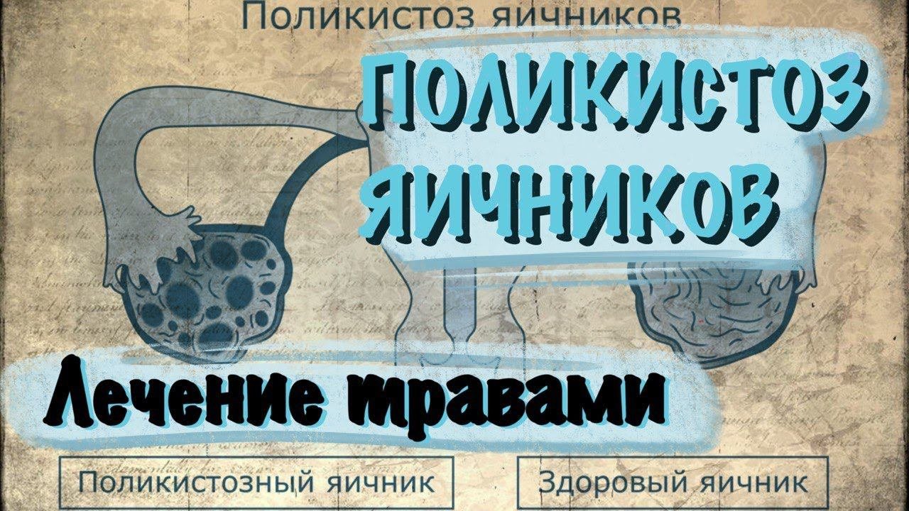 Народное средство как лечить яичники. Народное средство как лечить яичники