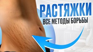 Как НАВСЕГДА избавиться от РАСТЯЖЕК? / Рабочие методы борьбы со стрии