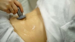 RF-лифтинг тела.