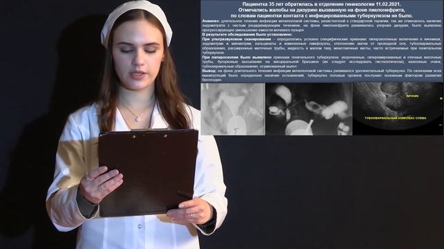 Туберкулез и материнство смотреть онлайн