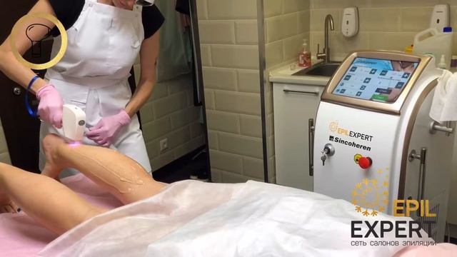 Как проходит лазерная эпиляция. Прямая трансляция из кабинета! смотреть онлайн