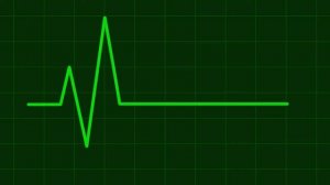 Анимация кардиограммы, пульс
