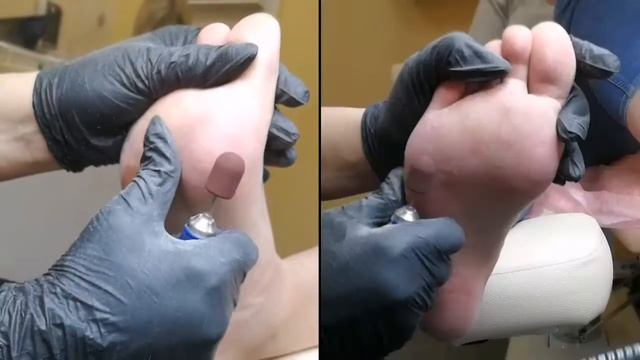 Комбинированный педикюр - Центр красоты Лисица смотреть онлайн