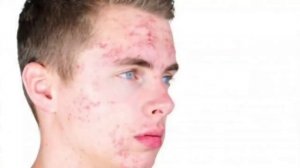 ГАЙД НА ЧИСТУЮ КОЖУ ЛИЦА - МУЖСКОЙ УХОД