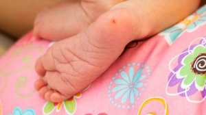 ЗАБОР КРОВИ ИЗ ПЯТКИ У НОВОРОЖДЕННОГО В РОДДОМЕ | Важность теста бланка для новорожденных