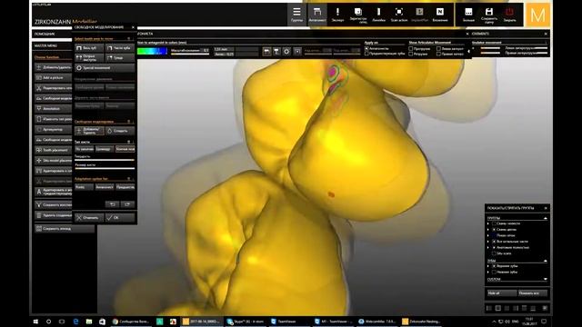 Тотальное протезирование, диоксид циркония, полная анатомия смотреть онлайн