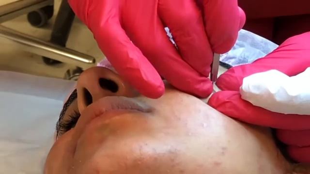 ГЛУБОКОЕ ОЧИЩЕНИЕ КОЖИ ЛИЦА В КАБИНЕТЕ КОСМЕТОЛОГА